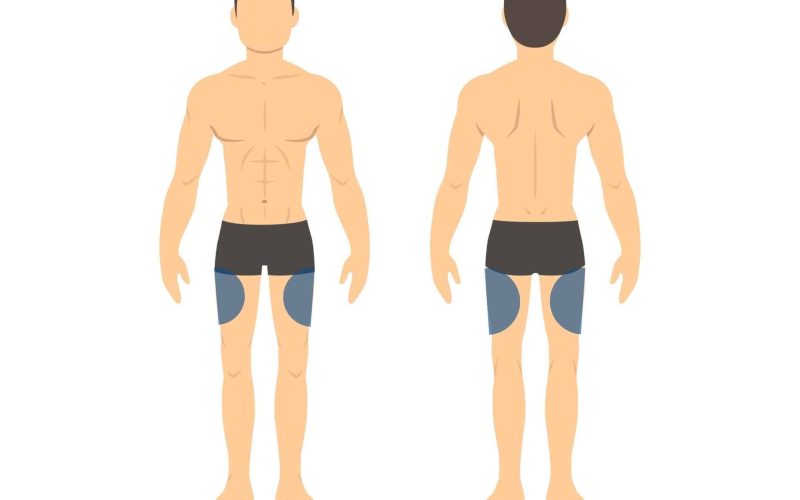 Can-You-Put-Dexcom-G6-on-Your-Leg